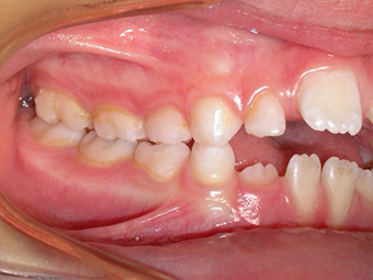 Ortodonzia Posturale