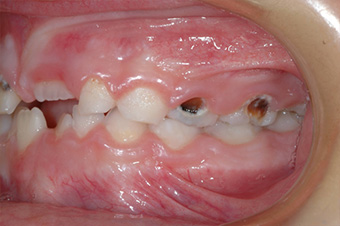 Prevenzione dentale e igiene